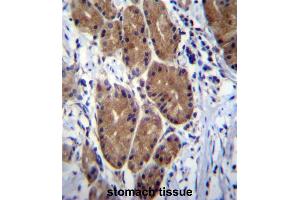 ZCRB1 Antibody (C-term) immunohistochemistry analysis in formalin fixed and paraffin embedded human stomach tissue followed by peroxidase conjugation of the secondary antibody and DAB staining. (ZCRB1 anticorps  (C-Term))