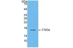 Detection of Recombinant TGFb2, Human using Polyclonal Antibody to Transforming Growth Factor Beta 2 (TGFb2) (TGFB2 anticorps  (AA 303-414))