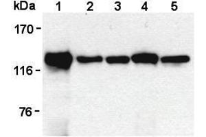 Western Blotting (WB) image for anti-Signal-Induced Proliferation-Associated 1 (SIPA1) antibody (ABIN1449259) (SIPA1 anticorps)