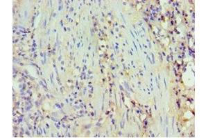 Immunohistochemistry of paraffin-embedded human epityphlon tissue using ABIN7173805 at dilution of 1:100 (BAFF anticorps  (AA 76-285))