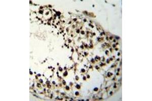 Immunohistochemistry analysis in formalin fixed and paraffin embedded human testis tissue reacted with LIN28A Antibody (Center) followed which was peroxidase conjugated to the secondary antibody and followed by DAB staining.