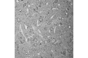 IHC on rat brain (paraffin sections) using Rabbit antibody to RhoA   at a concentration of 15 µg/ml, incubated overnight and developed with DAB Ni.