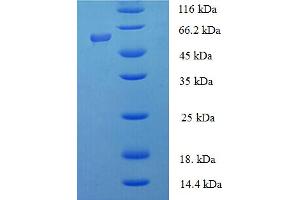 SDS-PAGE (SDS) image for Inositol Polyphosphate-5-Phosphatase, 40kDa (INPP5A) (AA 1-409), (full length) protein (His-SUMO Tag) (ABIN5711313) (INPP5A Protein (AA 1-409, full length) (His-SUMO Tag))