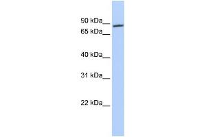WB Suggested Anti-AR Antibody Titration: 0. (Androgen Receptor anticorps  (N-Term))