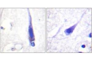 Immunohistochemistry analysis of paraffin-embedded human brain tissue, using Calmodulin (Ab-79/81) Antibody. (Calmodulin 1 anticorps  (AA 46-95))