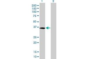 Western Blot analysis of XPA expression in transfected 293T cell line by XPA MaxPab polyclonal antibody. (XPA anticorps  (AA 1-273))