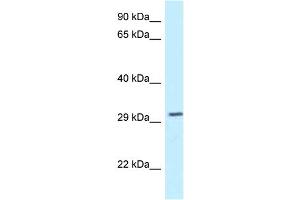 WB Suggested Anti-Tollip Antibody   Titration: 1. (TOLLIP anticorps  (N-Term))