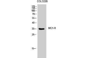 Western Blotting (WB) image for anti-Melanocortin 1 Receptor (MC1R) (C-Term) antibody (ABIN3185484) (MC1 Receptor anticorps  (C-Term))