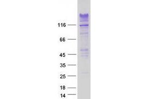 Validation with Western Blot