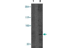 Western blot analysis of CNOT4 in A-549 lysate with CNOT4 polyclonal antibody  at (Lane 1) 1 and (Lane 2) 2 ug/mL . (CNOT4 anticorps  (N-Term))