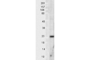 Western blot analysis of Rat Tissue lysates showing detection of SOD2 protein using Rabbit Anti-SOD2 Polyclonal Antibody . (SOD2 anticorps  (Biotin))