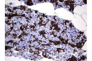 Immunohistochemistry (IHC) image for anti-Keratin Acidic (AE1) antibody (ABIN2715666)