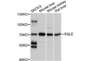 Western blot analysis of extracts of various cell lines, using SQLE antibody (ABIN5998952) at 1/1000 dilution. (SQLE anticorps)