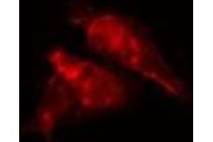 ABIN6277218 staining  HepG2 cells by IF/ICC. (EPB41 anticorps  (Internal Region))