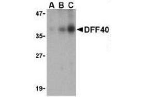Immunocytochemical staining of DFF40 in K562 cells with DFF40 antibody at 10μg/ml. (DFFB anticorps  (AA 203-218))