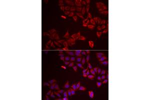 Immunofluorescence analysis of A549 cells using LGALS8 antibody. (LGALS8 anticorps)