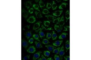 Immunofluorescence analysis of L929 cells using MTIF2 Polyclonal Antibody (ABIN7268591) at dilution of 1:100 (40x lens). (MTIF2 anticorps  (AA 428-727))