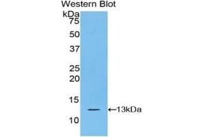 Detection of Recombinant S100A10, Bovine using Polyclonal Antibody to S100 Calcium Binding Protein A10 (S100A10) (S100A10 anticorps)