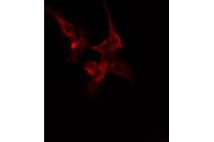 ABIN6275448 staining Hela cells by IF/ICC. (RIN1 anticorps  (C-Term))