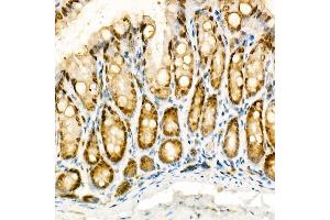Immunohistochemistry of paraffin-embedded mouse colon using [KO Validated] NADPH oxidase 4 (NOX4) Rabbit pAb (ABIN6128328, ABIN6144752, ABIN6144753 and ABIN6215143) at dilution of 1:100 (40x lens). (NADPH Oxidase 4 anticorps  (AA 328-578))
