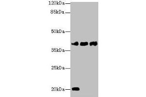 Western blot All lanes: STEAP1 antibody at 1 μg/mL Lane 1: U87 whole cell lysate Lane 2: A431 whole cell lysate Lane 3: A549 whole cell lysate Secondary Goat polyclonal to rabbit IgG at 1/10000 dilution Predicted band size: 40 kDa Observed band size: 40 kDa (STEAP1 anticorps  (AA 3-69))