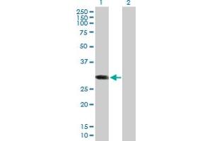 Western Blot analysis of ABCC10 expression in transfected 293T cell line by ABCC10 MaxPab polyclonal antibody. (ABCC10 anticorps  (AA 1-282))