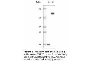Image no. 2 for anti-zeta-Chain (TCR) Associated Protein Kinase 70kDa (ZAP70) antibody (ABIN207619) (ZAP70 anticorps)