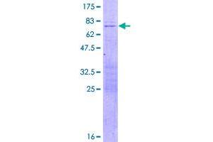 Image no. 1 for Short Stature Homeobox 2 (SHOX2) (AA 1-355) protein (GST tag) (ABIN1319960)