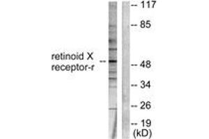 Western Blotting (WB) image for anti-Retinoid X Receptor, gamma (RXRG) (AA 171-220) antibody (ABIN6765619) (Retinoid X Receptor gamma anticorps  (AA 171-220))