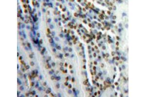 IHC-P analysis of Kidney tissue, with DAB staining. (SNRPC anticorps  (AA 2-159))