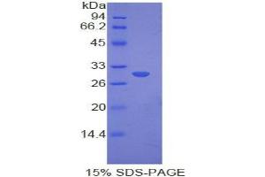 SDS-PAGE analysis of Mouse Myosin IE Protein. (MYO1E Protéine)