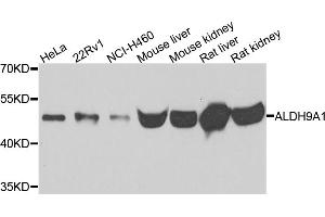 Western blot analysis of extracts of various cell lines, using ALDH9A1 antibody (ABIN5995392) at 1/500 dilution. (ALDH9A1 anticorps)