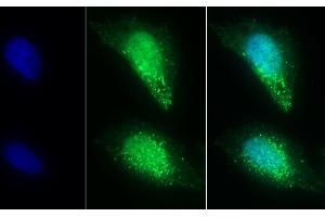 Detection of ST2 in Human U2OS cell using Polyclonal Antibody to Syntenin 2 (ST2) (SDCBP2 anticorps  (AA 1-292))