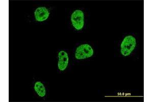 Immunofluorescence of monoclonal antibody to CDX1 on HeLa cell. (CDX1 anticorps  (AA 126-215))