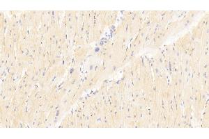 Detection of TRAF6 in Human Cardiac Muscle Tissue using Polyclonal Antibody to TNF Receptor Associated Factor 6 (TRAF6)