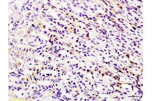 Immunohistochemistry (Paraffin-embedded Sections) (IHC (p)) image for anti-DEAD (Asp-Glu-Ala-Asp) Box Polypeptide 58 (DDX58) (AA 201-300) antibody (ABIN730663) (DDX58 anticorps  (AA 201-300))