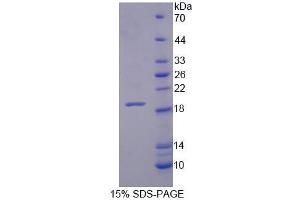 SDS-PAGE analysis of Human XYLT1 Protein. (XYLT1 Protéine)