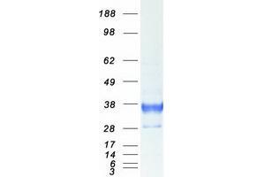 Validation with Western Blot