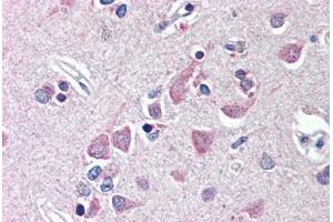 Human Brain, Cortex (formalin-fixed, paraffin-embedded) stained with FEM1B antibody ABIN214493 at 10 ug/ml followed by biotinylated goat anti-rabbit IgG secondary antibody ABIN481713, alkaline phosphatase-streptavidin and chromogen. (FEM1B anticorps  (AA 609-622))