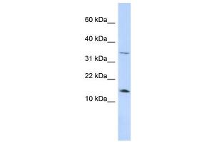 Leptin antibody used at 1 ug/ml to detect target protein. (Leptin anticorps  (Middle Region))