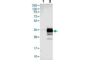 Western blot analysis of Lane 1: Negative control (vector only transfected HEK293T lysate). (STARD3NL anticorps)