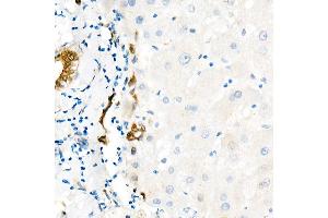 Immunohistochemistry of paraffin-embedded Human liver (negative control sample) using Y antibody (ABIN7271418) at dilution of 1:1000 (40x lens).