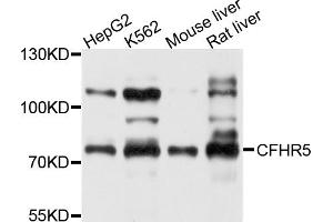 Western blot analysis of extracts of various cell lines, using CFHR5 antibody (ABIN5997428) at 1/1000 dilution.