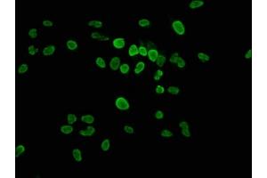 Immunofluorescence staining of Hela cells with ABIN7139625 at 1:2. (HIST1H1E anticorps  (pThr17))