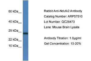 Western Blotting (WB) image for anti-NADH Dehydrogenase (Ubiquinone) Flavoprotein 2, 24kDa (NDUFV2) (C-Term) antibody (ABIN2787254) (NDUFV2 anticorps  (C-Term))