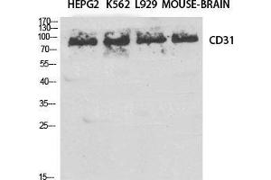 Western Blot (WB) analysis of specific cells using CD31 Polyclonal Antibody. (CD31 anticorps  (Thr224))