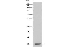 Western blot analysis of IP10 expression in IP10 recombinant protein lysate.