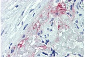 Human Placenta: Formalin-Fixed, Paraffin-Embedded (FFPE)