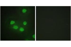 Immunofluorescence analysis of HepG2 cells, using SIX6 Antibody. (SIX Homeobox 6 anticorps  (AA 121-170))