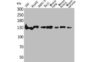 Western Blot analysis of 293 HepG2 BXPC-3 Raji mouse lung mouse brain mouse spleen cells using IL-16 Polyclonal Antibody (IL16 anticorps  (C-Term))